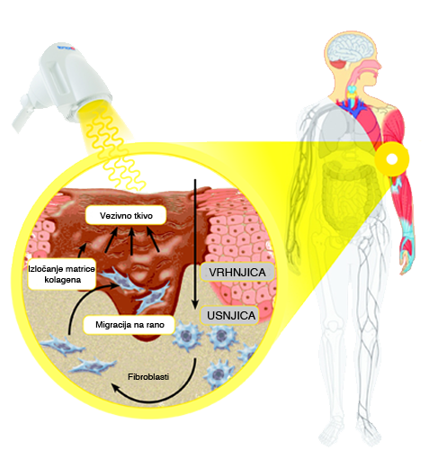 KAKO DELUJE SVETLOBA BIOPTRON